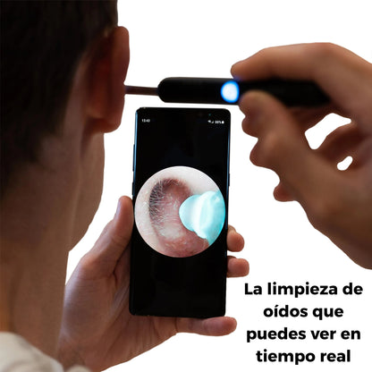 OtoView™ - Limpiador de oidos con cámara HD